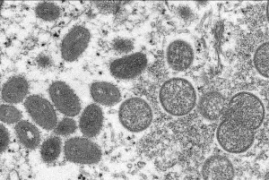 SES confirma segundo caso de varíola dos macacos no RS