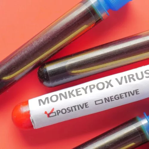 Teste de Varíola dos macacos (Foto: Banco de imagens Canva)